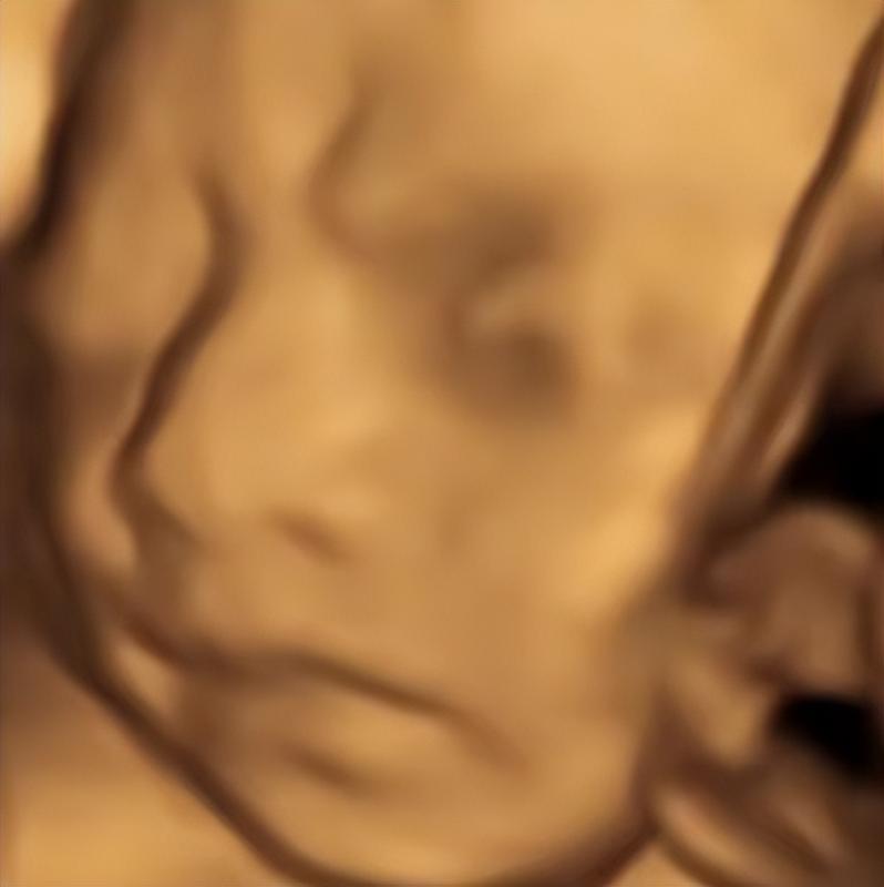 图片[2]-AI四维彩超预测，一单9.9-98，3分钟出图，一天变现1000+【揭秘】-副业网